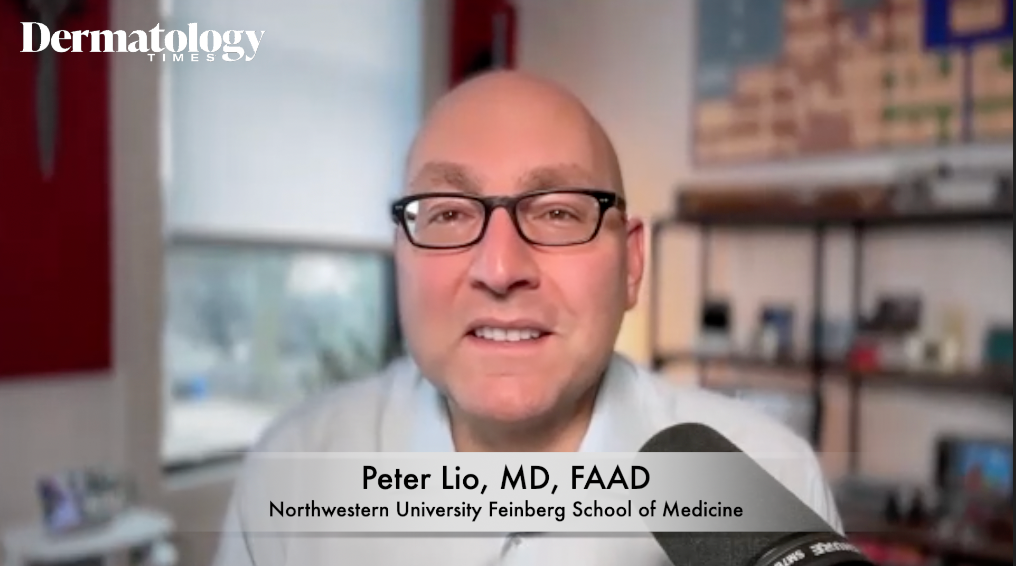 Peter Lio, MD, FAAD: Navigating Dietary Triggers in Urticaria and Atopic Dermatitis