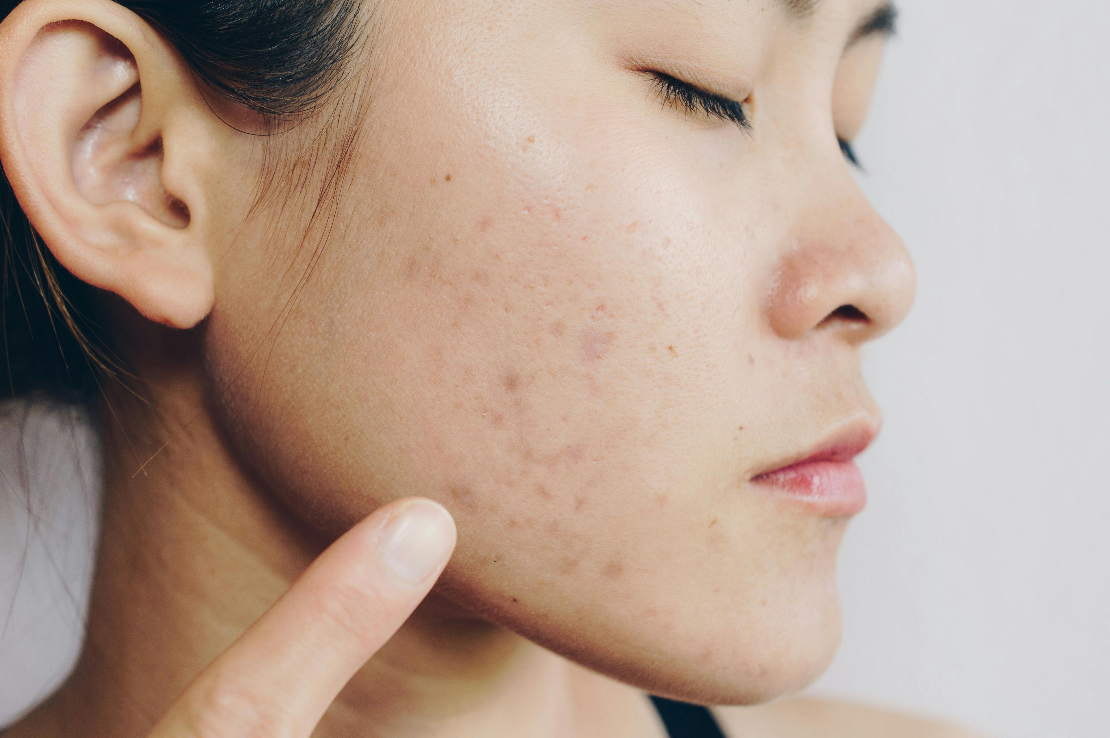 Dermatologic differences in a diverse population