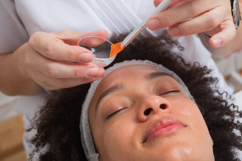 Finding the Best Peel for Your Skin of Color Patient