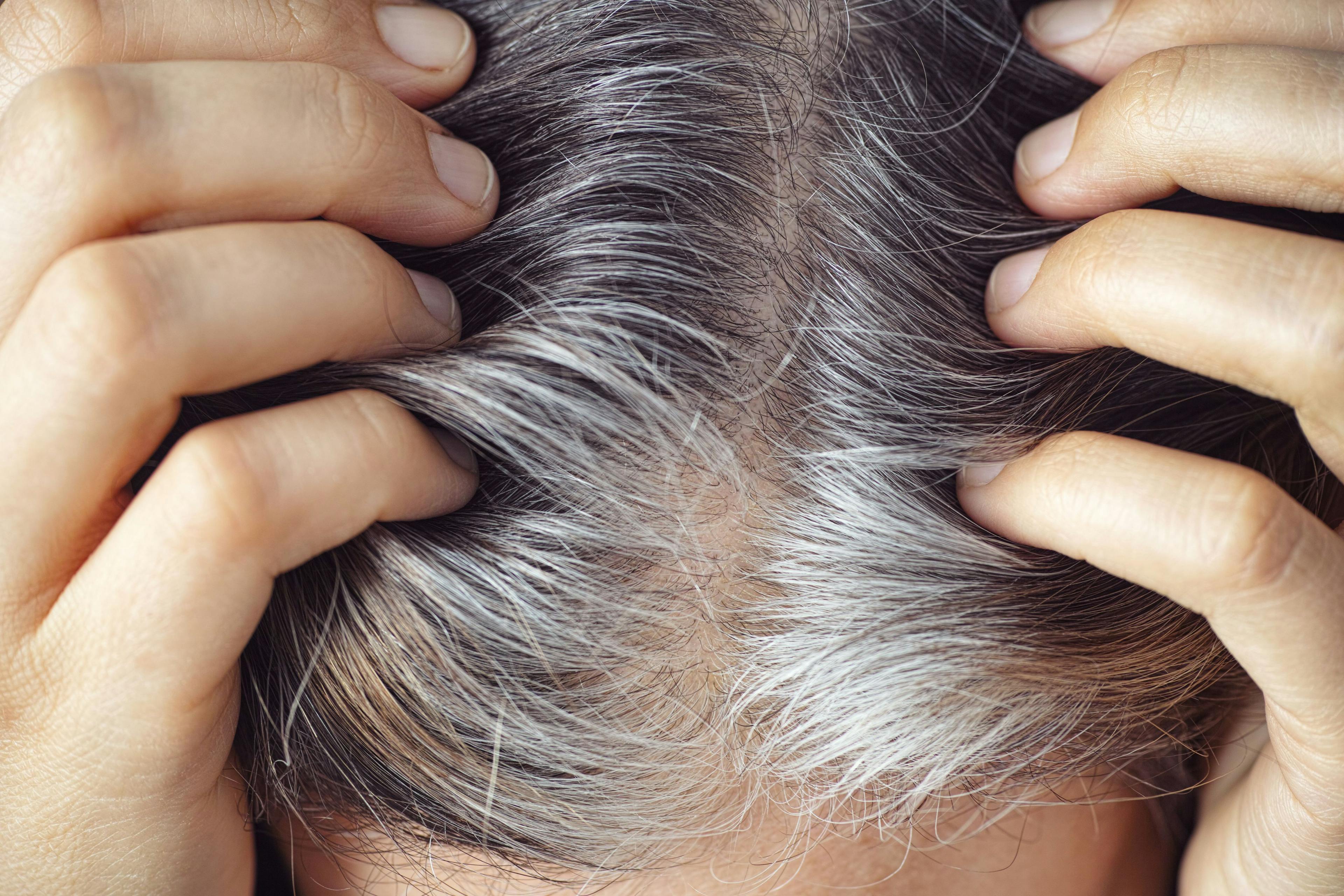 Decoding the Science of Graying Hair