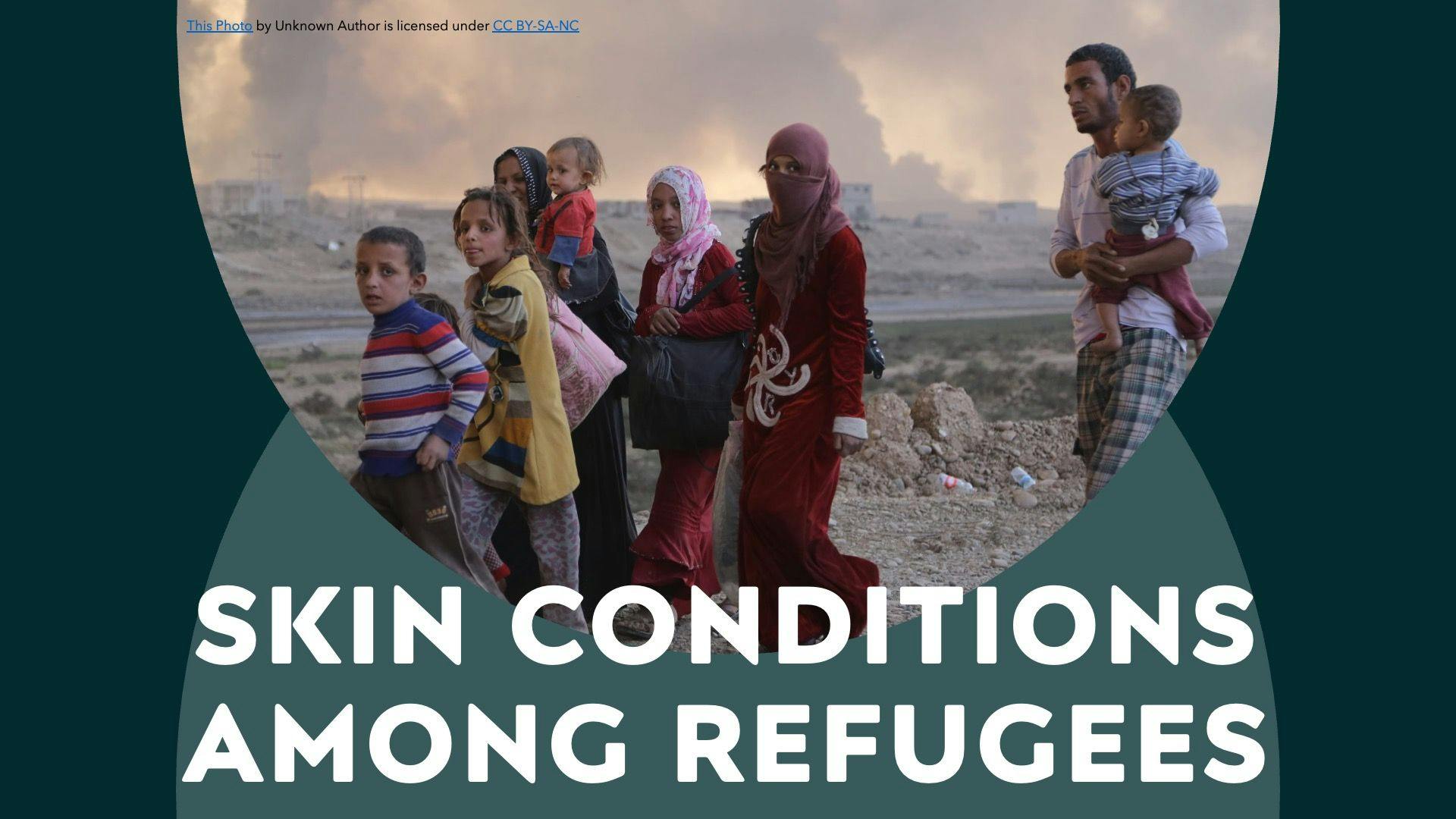 Study Outlines Common Skin Conditions Among Refugees