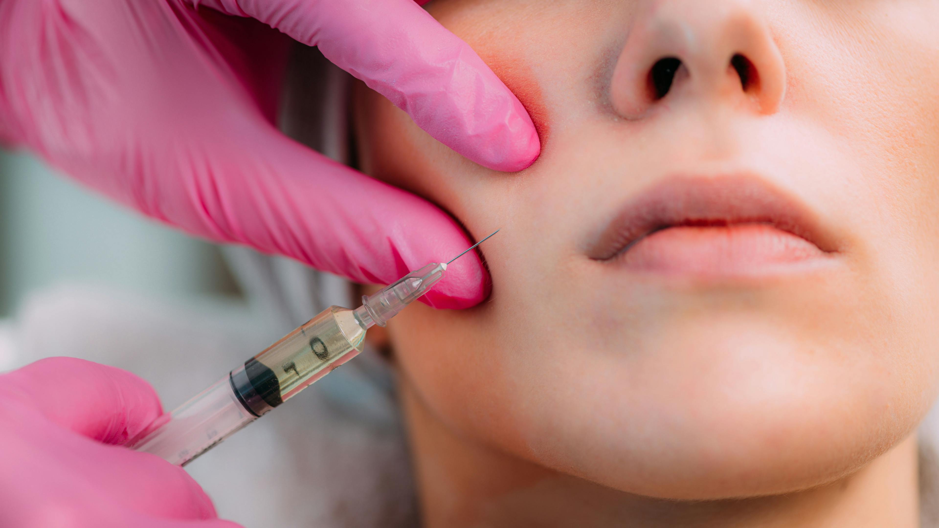 woman gets filler injection in cheek