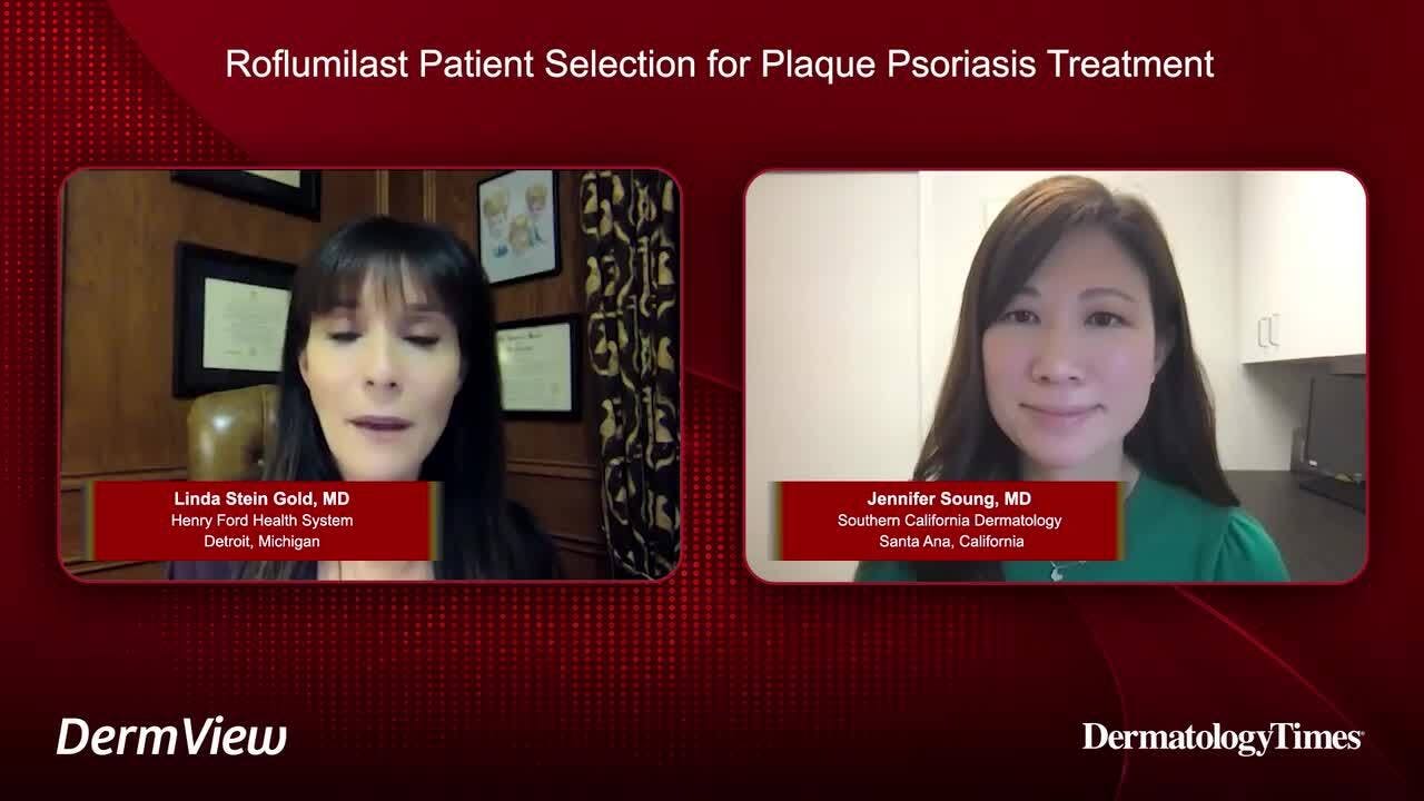 Roflumilast Patient Selection for Plaque Psoriasis Treatment