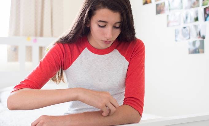 Teenage Girl Sitting In Bedroom Scratching Arm