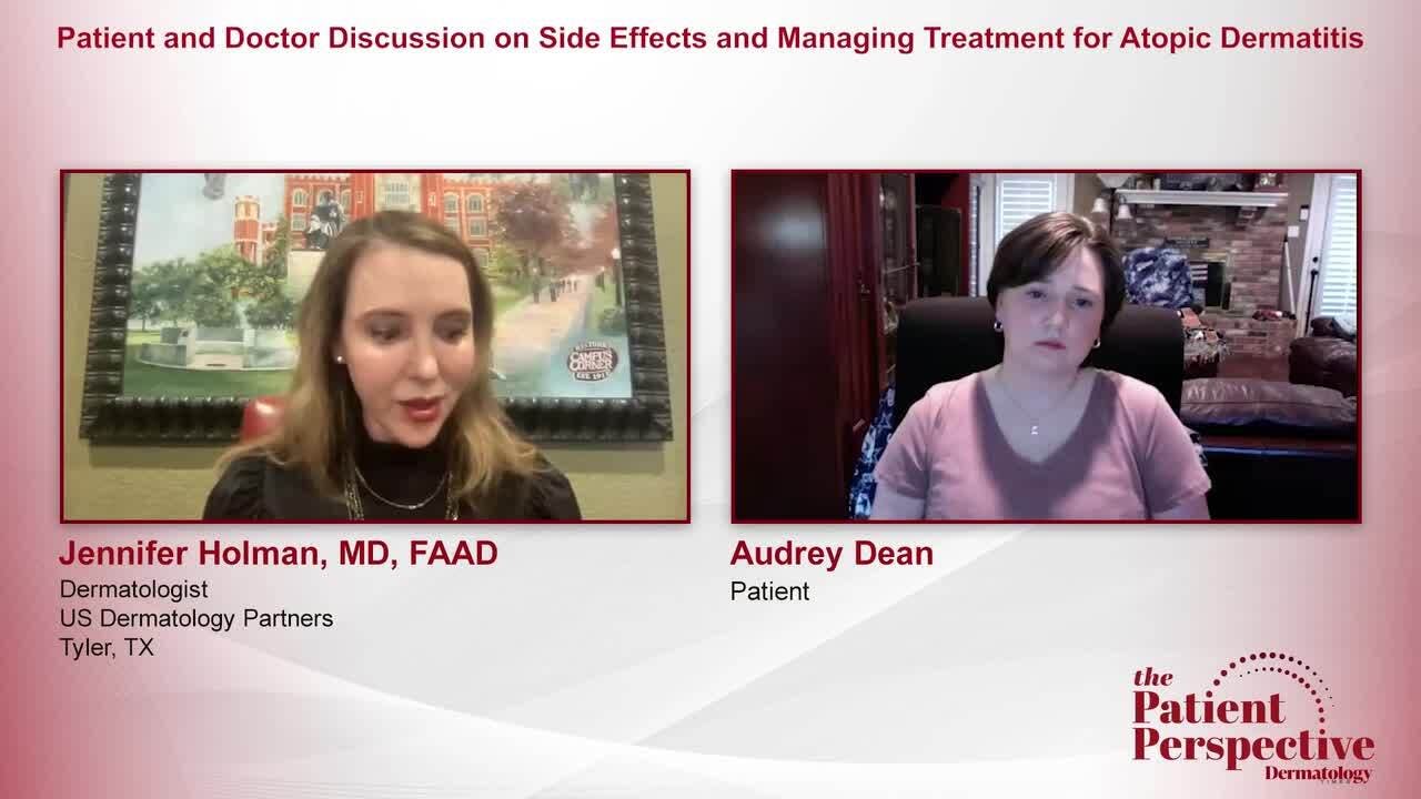 Patient and Doctor Discussion on Side Effects and Managing Treatment for Atopic Dermatitis 