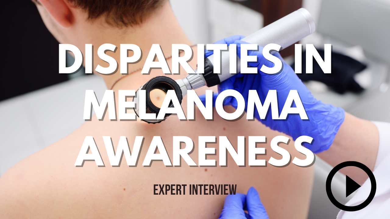Disparities in melanoma awareness