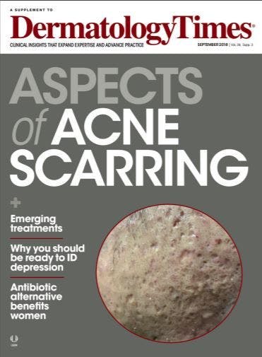 Special Dermatology Times supplement:  Acne scarring