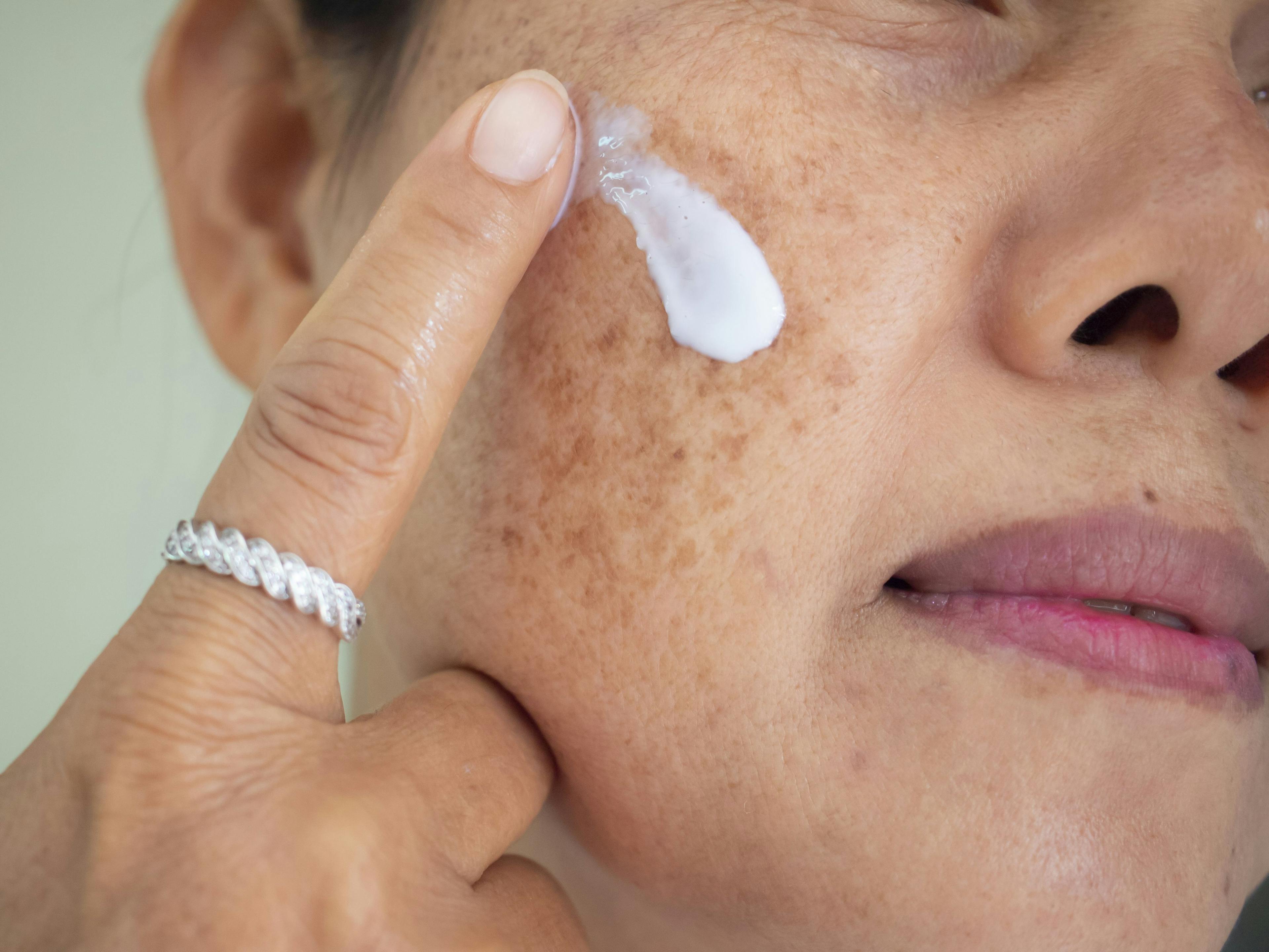 POLL: Is the skin care market too saturated?