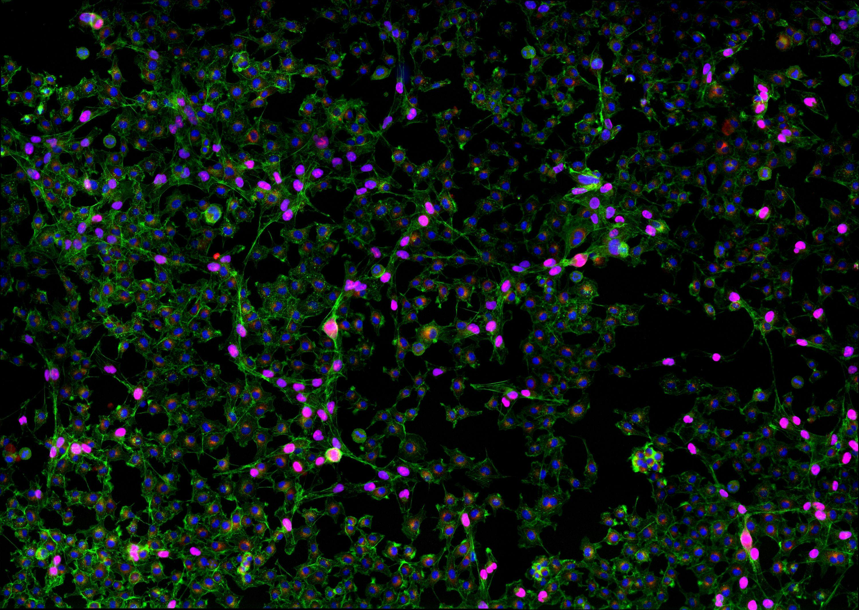 Neuronal-Like Communication Between Non-Neuron Skin Cells May Initiate Melanoma
