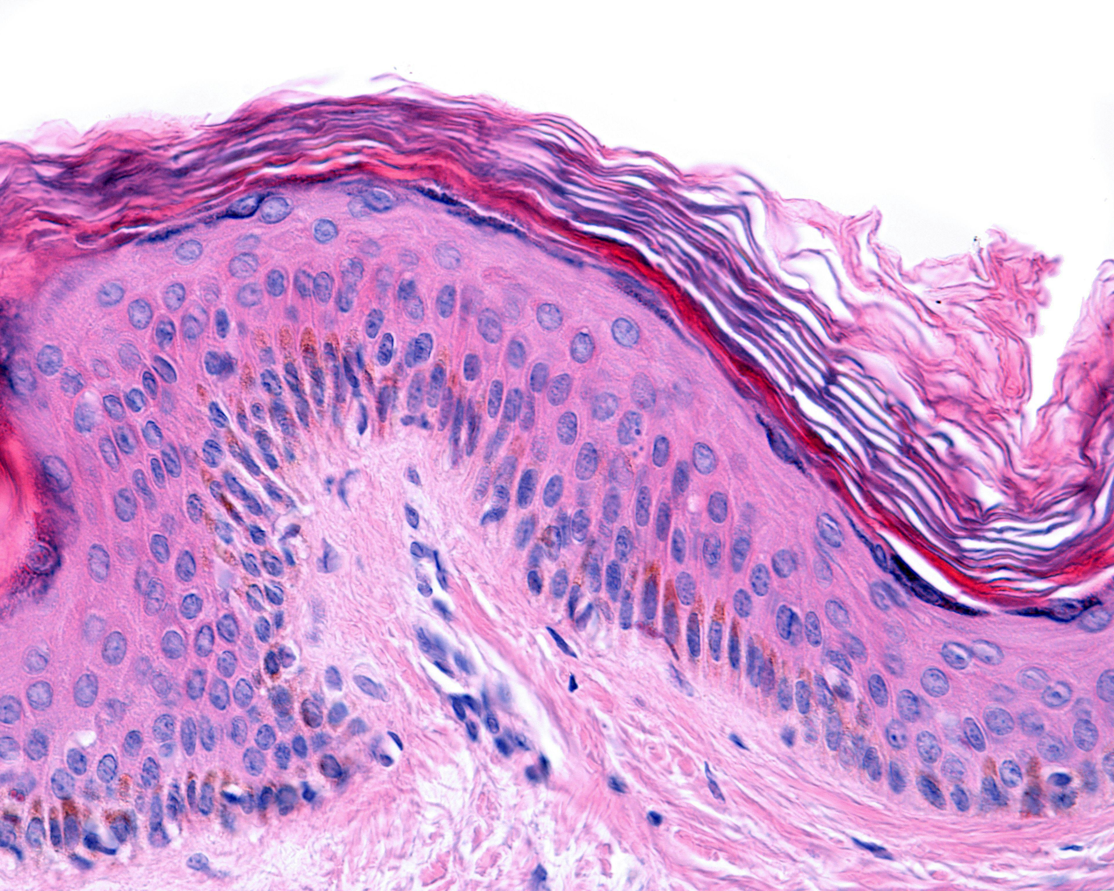 Taking a Comprehensive Approach to Common Vulvar Dermatoses
