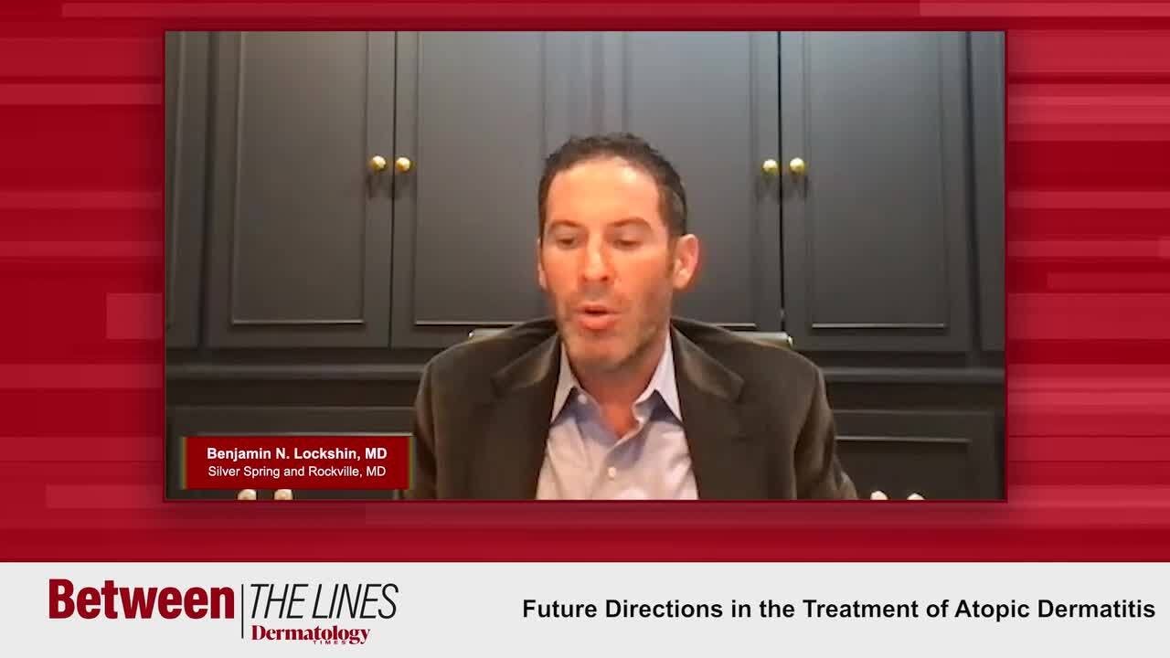 Future Directions in the Treatment of Atopic Dermatitis