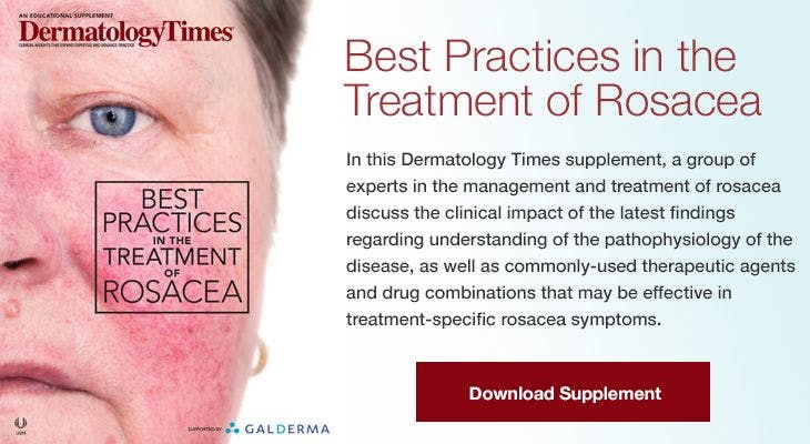 Best Practices in the Treatment of Rosacea