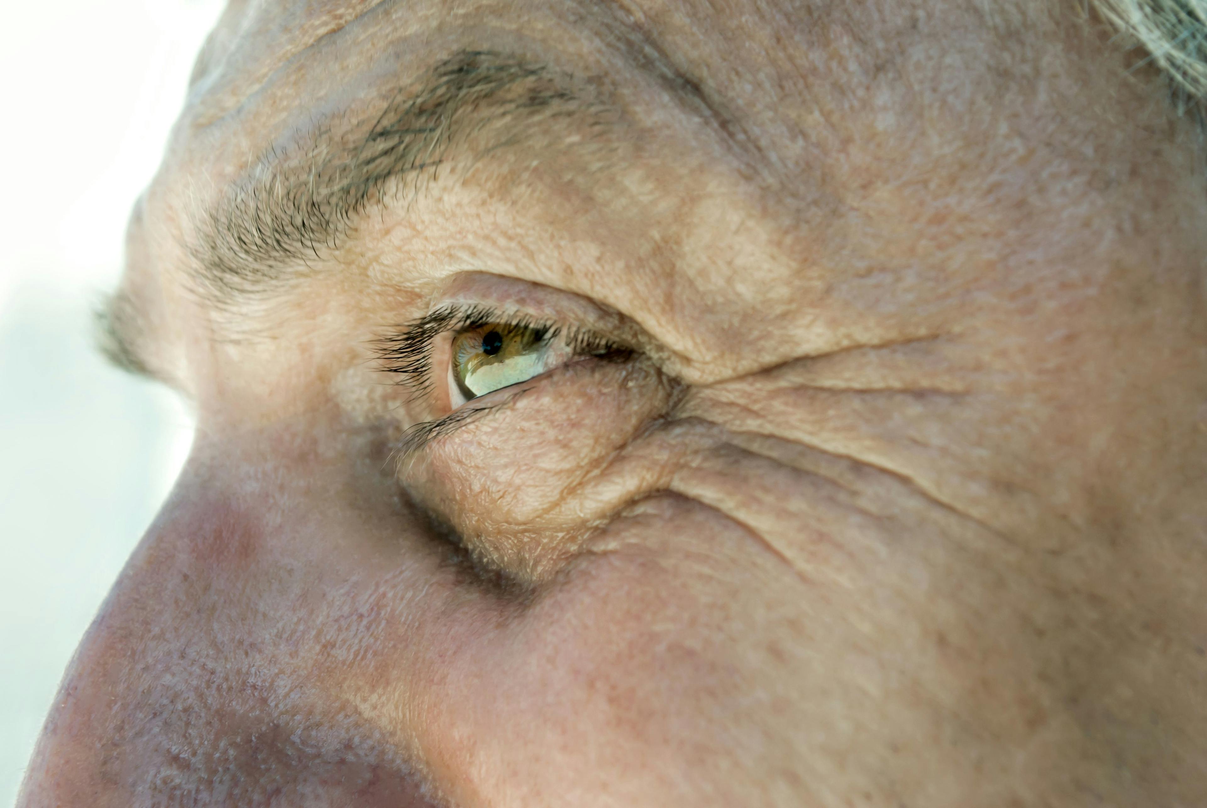 close up of man's face and skin