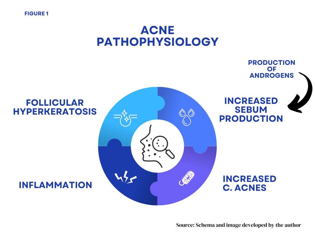 Pathophysiology of acne | Image credit: Michael Rubio