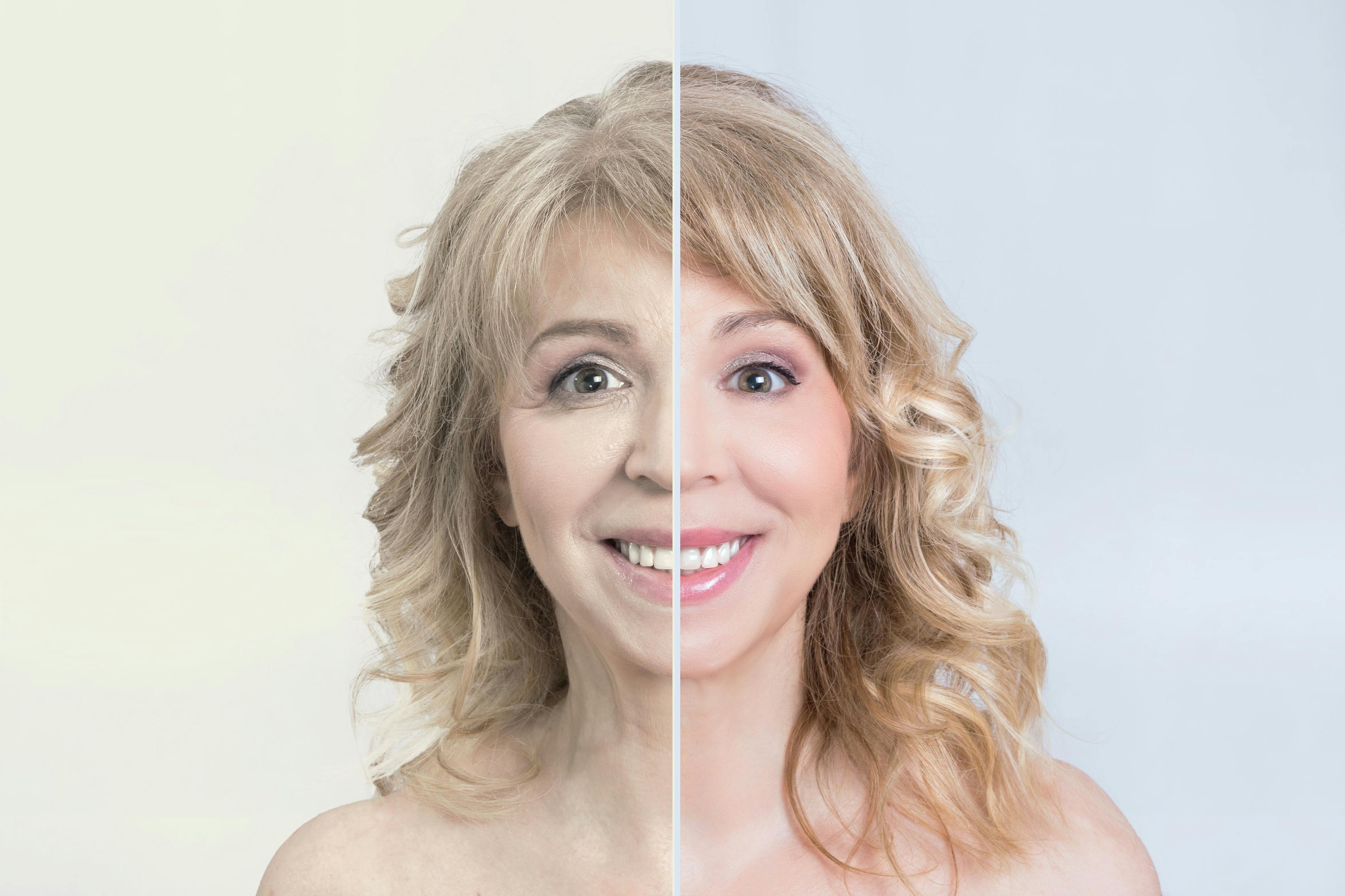 The two faces of botulinum toxin