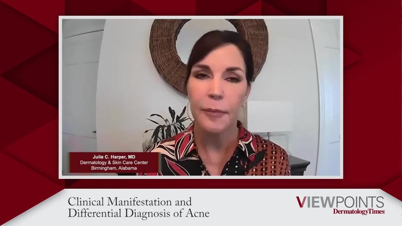 Clinical Manifestation and Differential Diagnosis of Acne