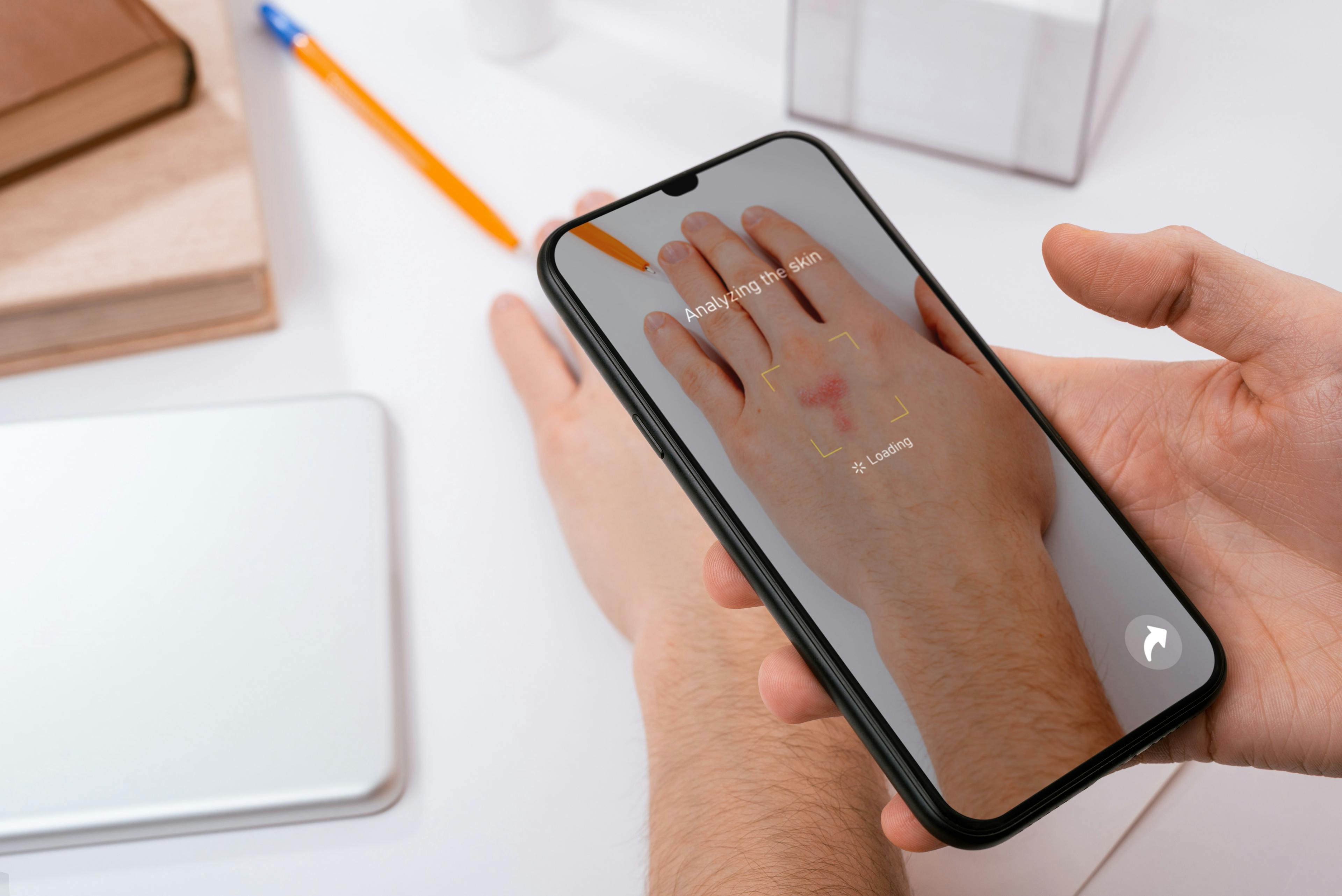 Person holds phone over hand to scan for skin issue using an app.