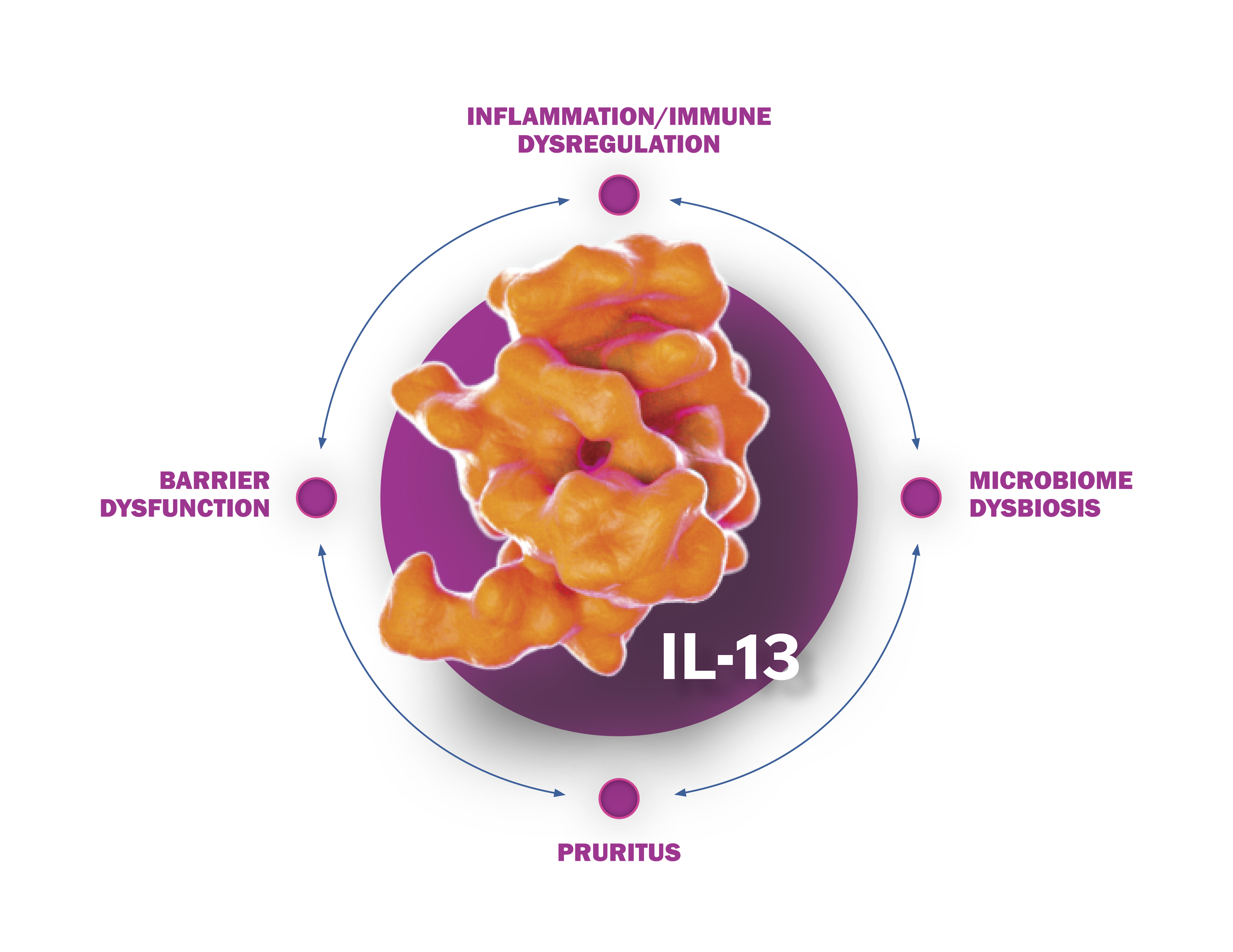 IL-13: a driver of inflammation in atopic dermatitis.