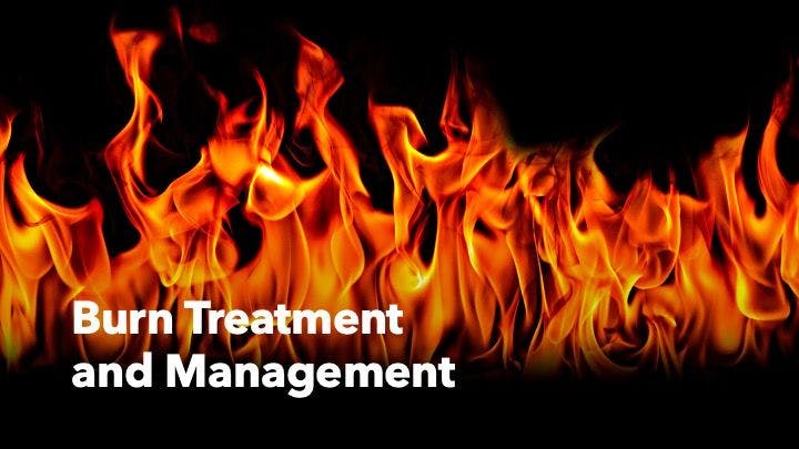 Burn Treatment and Management