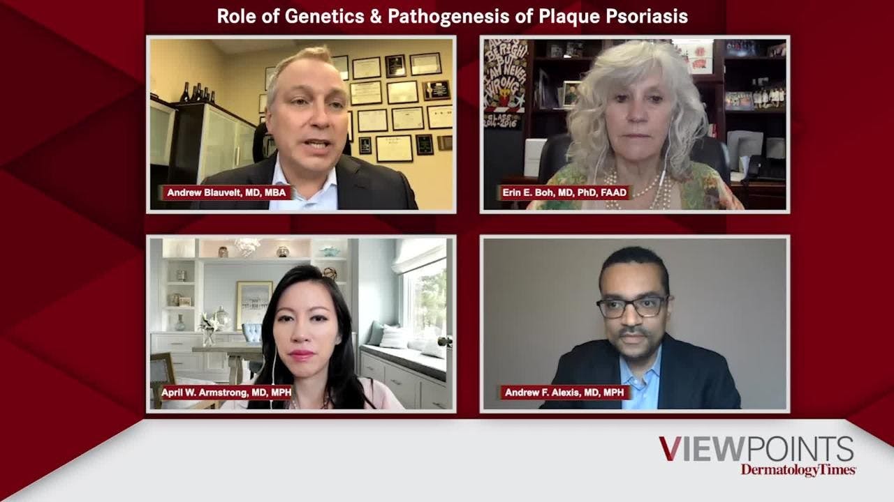 Role of Genetics & Pathogenesis of Plaque Psoriasis