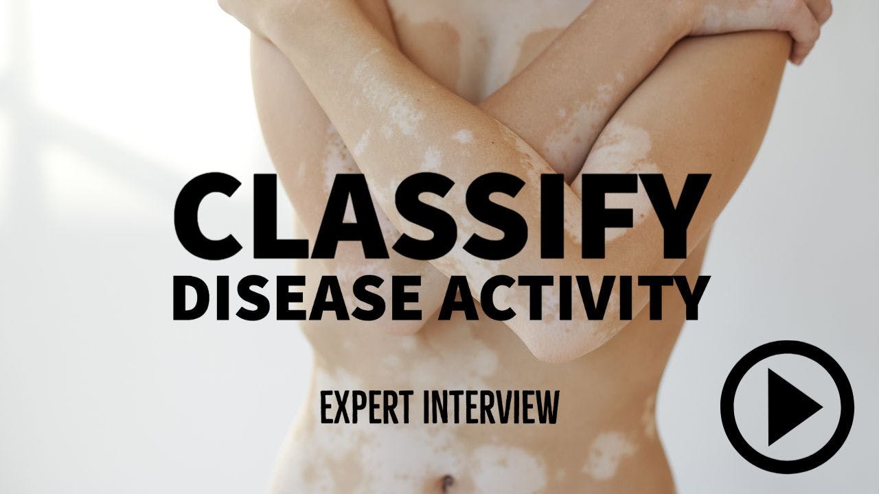 A person with vitiligo crossing arms over torso. Writing: Classify Disease Activity - Expert Interview