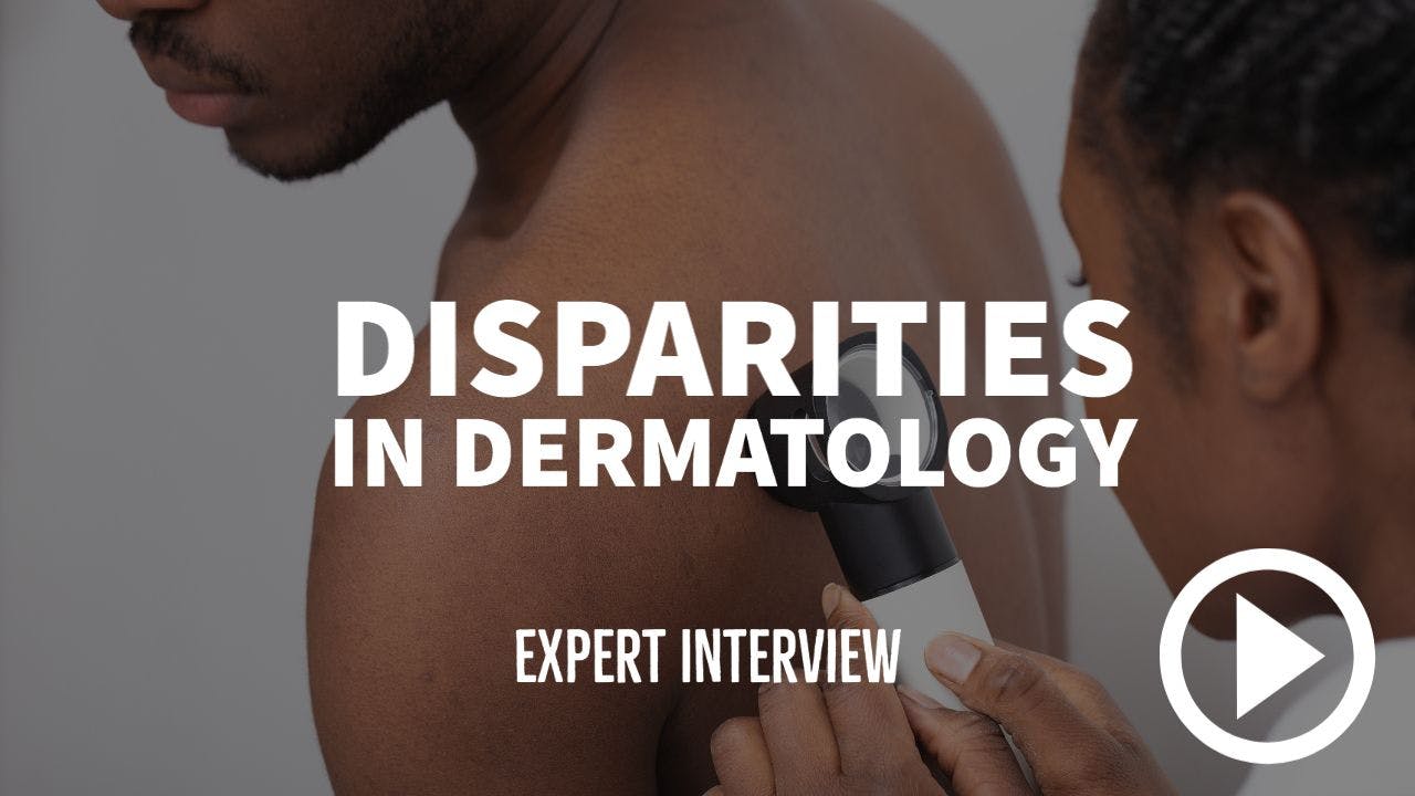 doctor examining mole in dark skinned patient with writing "Disparities in Dermatology - Expert Interview"