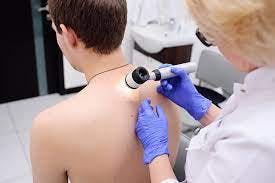 Who is Getting a Skin Cancer Screening?