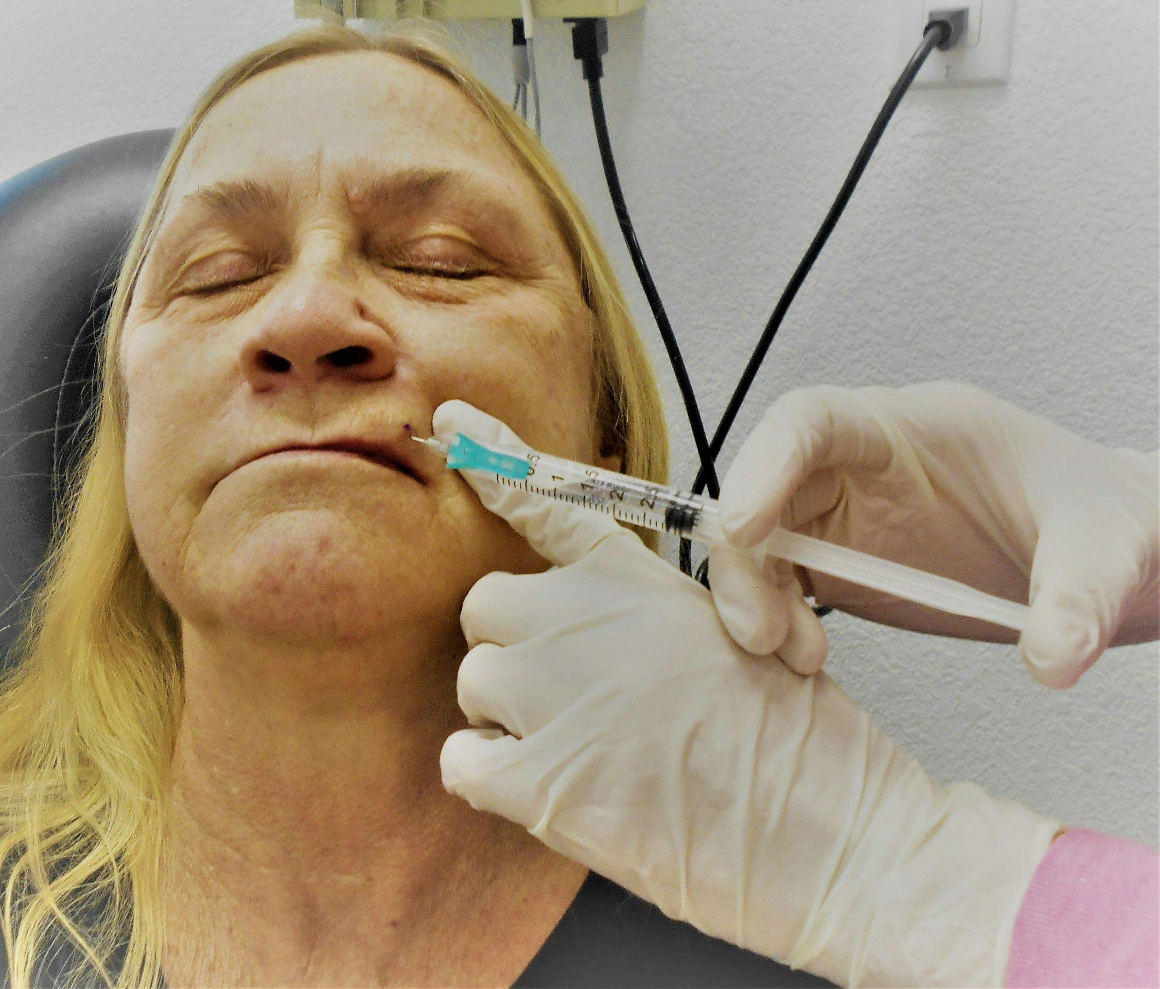 Lidocaine injection in face | Image credit: AZ-BLT/Envato Elements