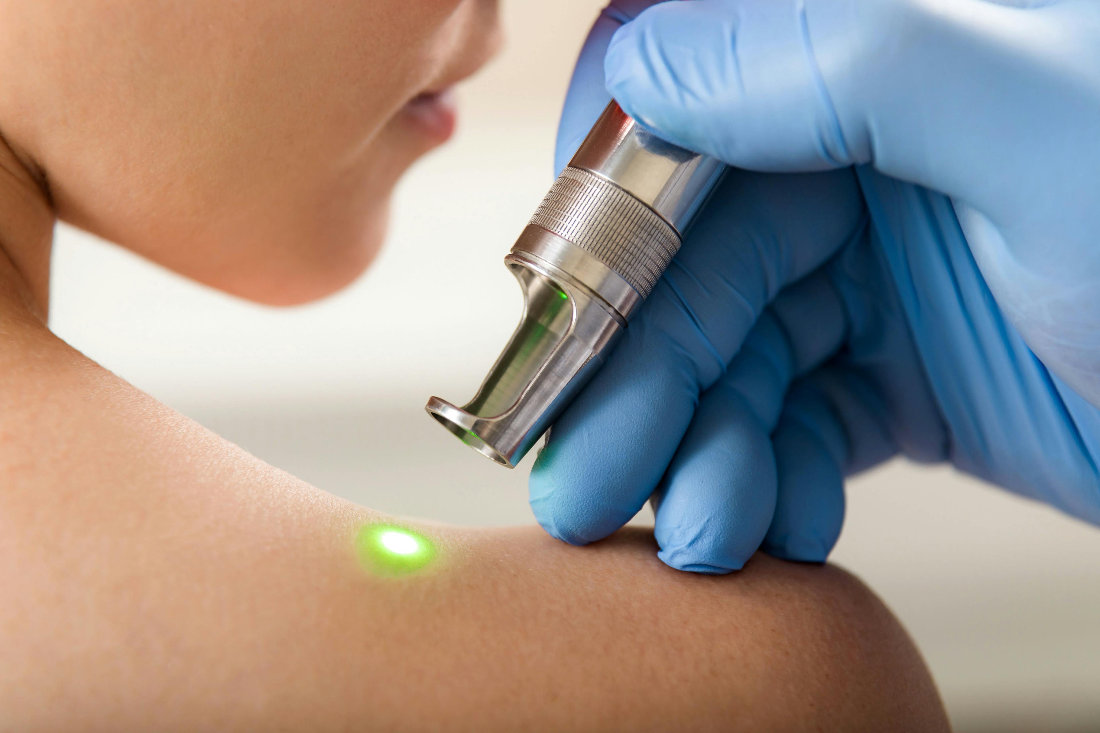 5 Perspectives on Laser Treatment in Dermatology