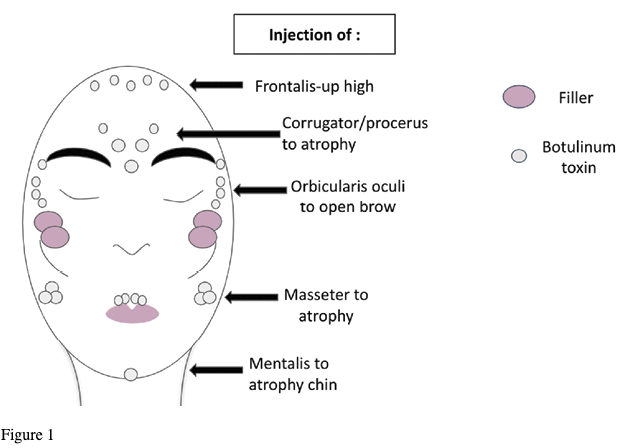 Figure 1. Male-to-Female (MtF) gender affirmation
injectable example. Of note, not all patients are seeking MtF injectables.