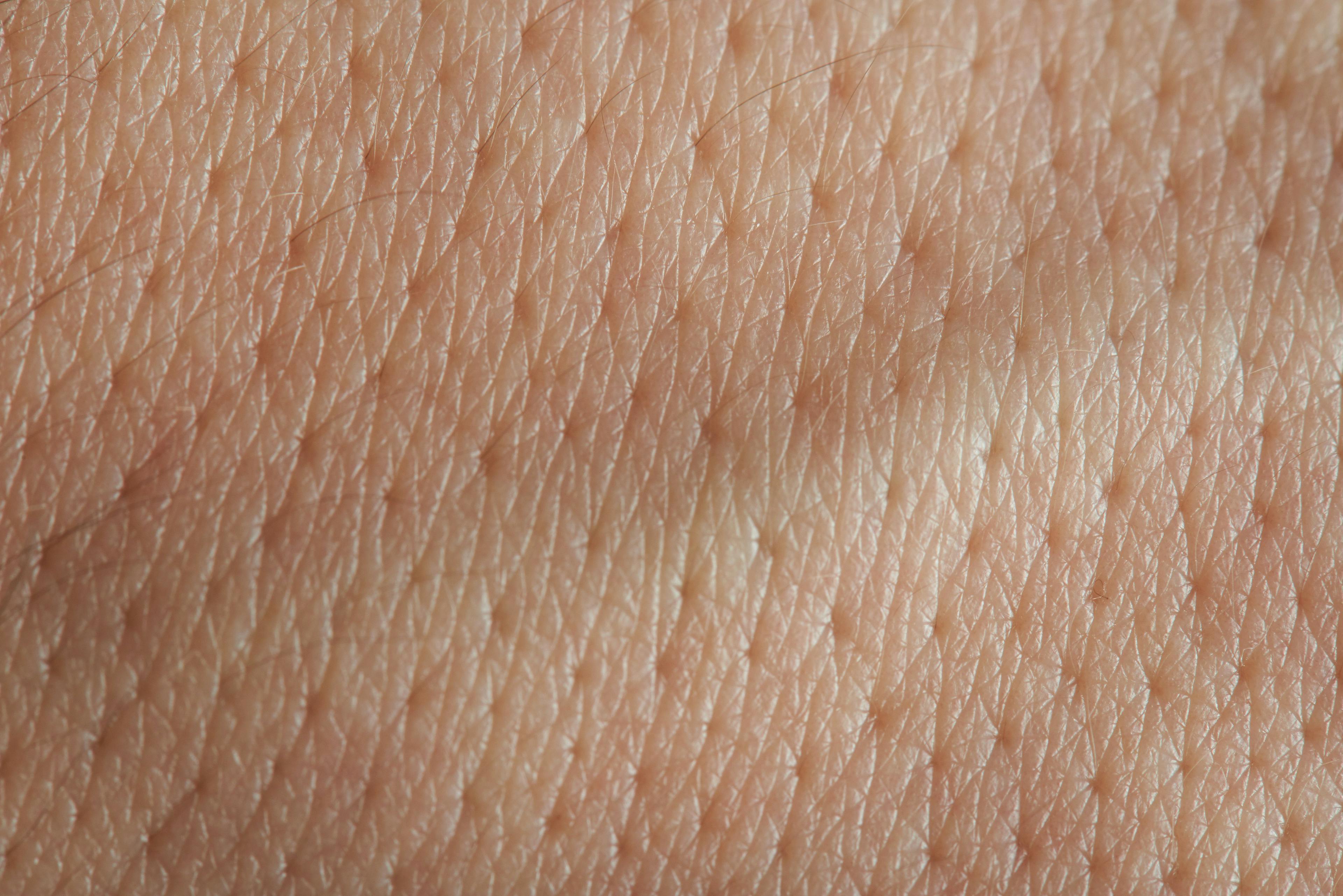 skin pores