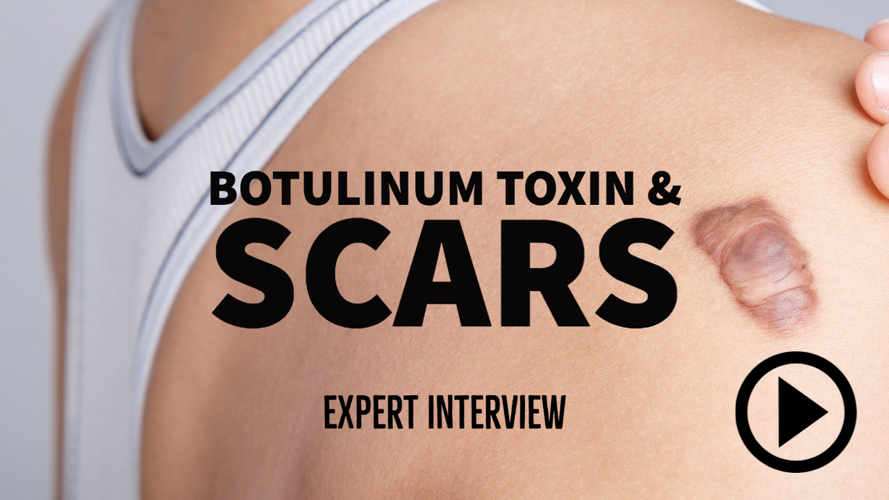Botulinum toxin and scars