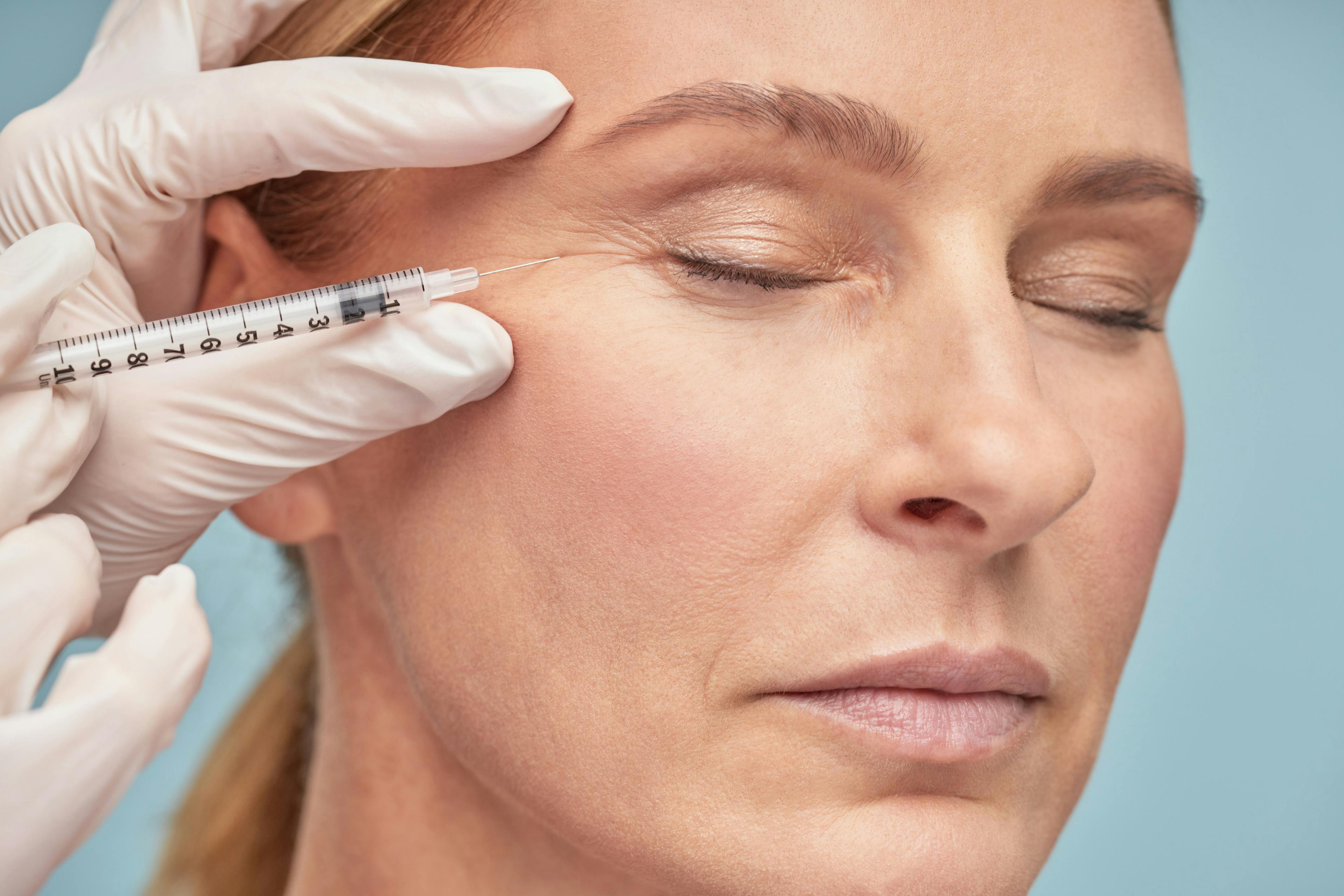 Hyaluronic Acid-Based Fillers Effective in Treating Signs of Aging