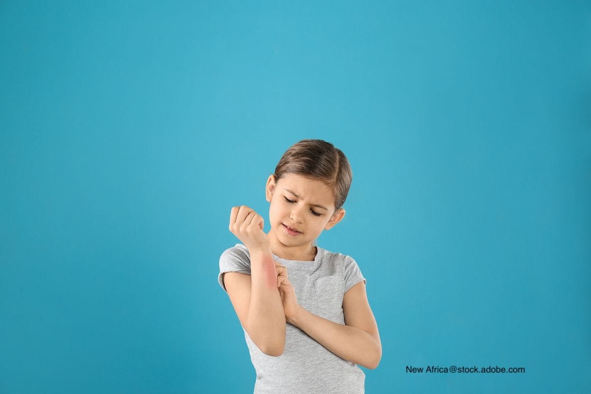 Two Common Causes for Itchy Rash in Children