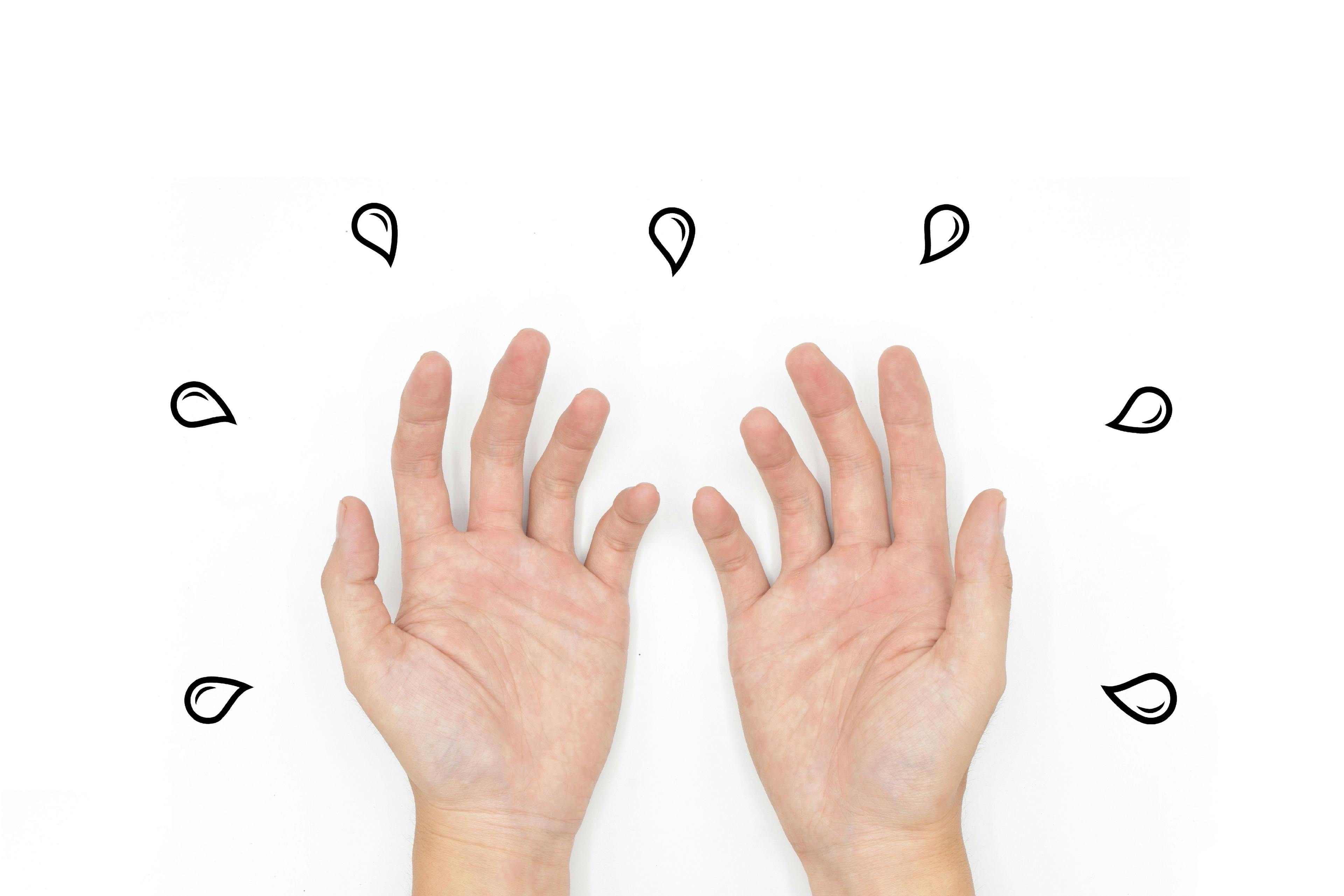 POLL: What Is Your Go-to Treatment for Severe Palmar Hyperhidrosis?