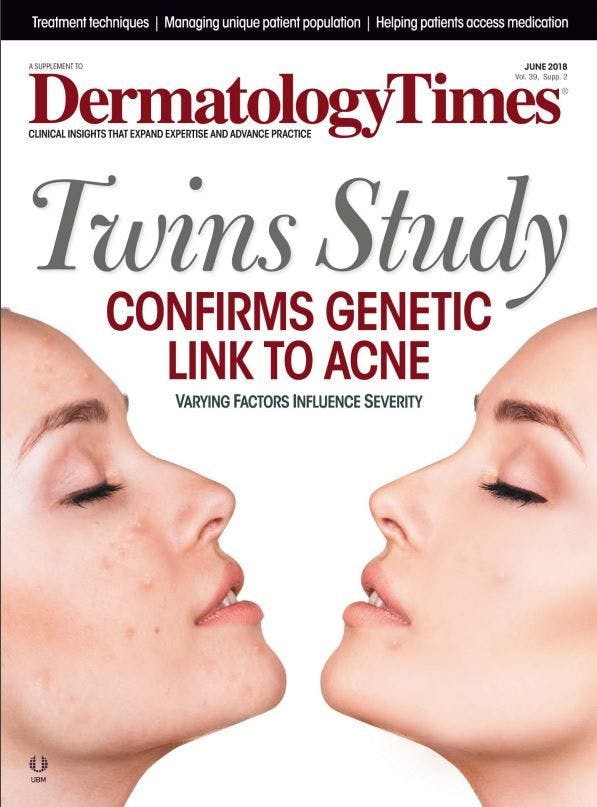 The June 2018 issue of Dermatology Times acne supplement.