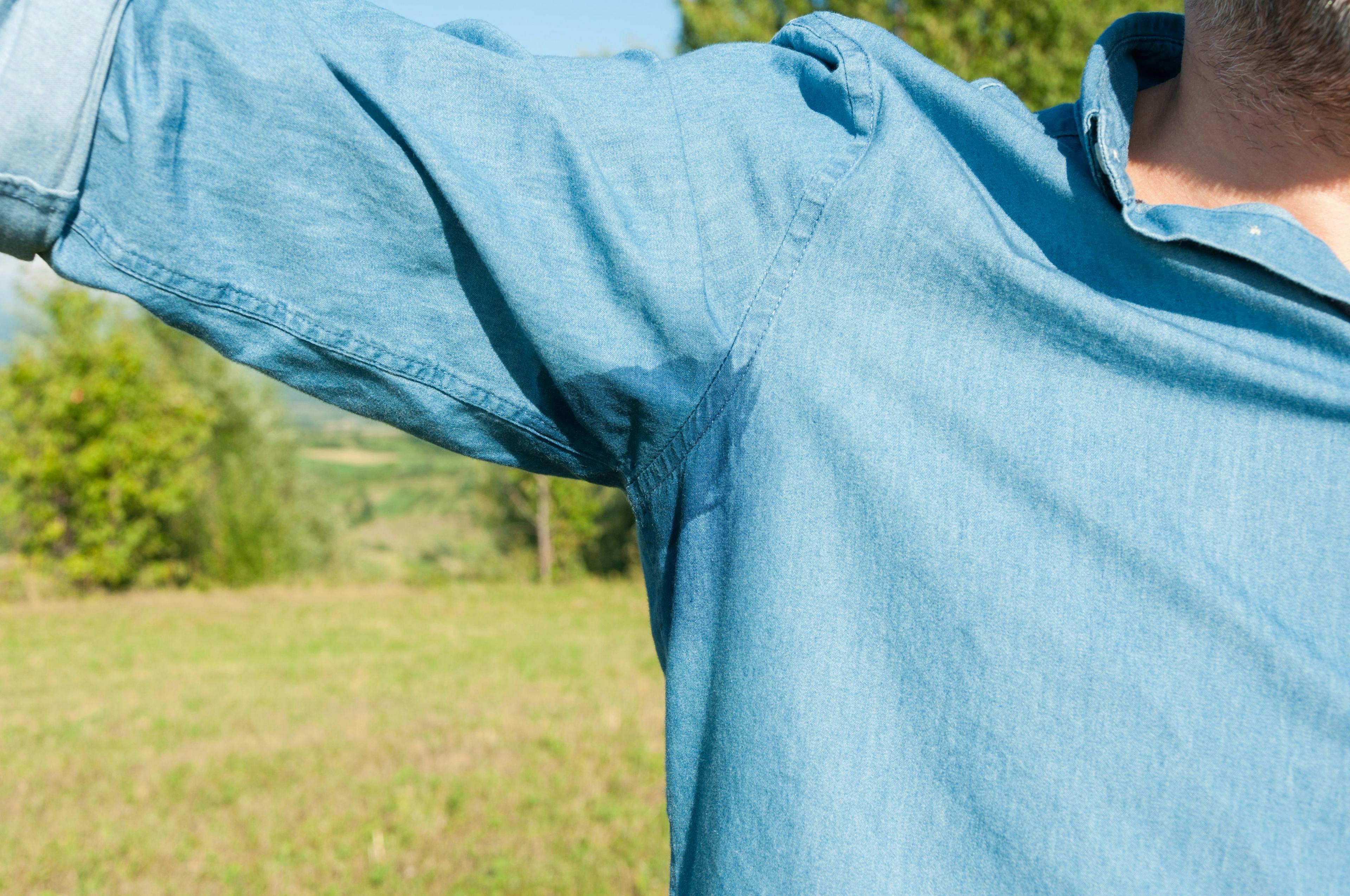 FDA approves treatment for underarm sweating