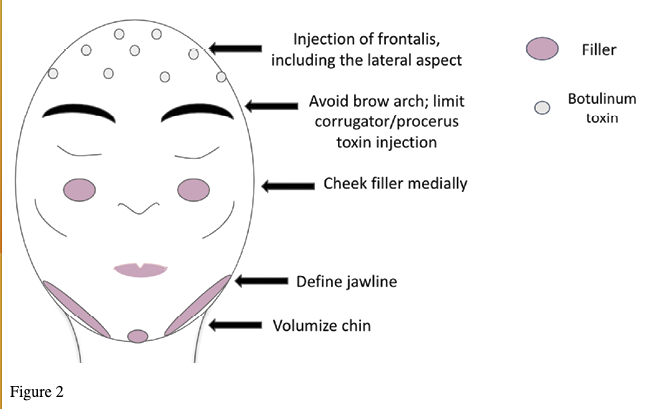 Figure 2. Female-to-Male (FtM) gender affirmation
injectable example. Of note, not all patients are seeking FtM injectables.