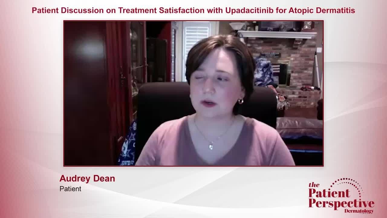 Patient Discussion on Treatment Satisfaction with Upadacitinib for Atopic Dermatitis 