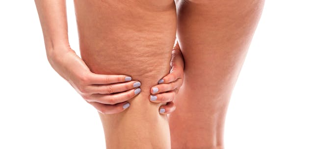 Sentient Sculpt Microwave Therapy for Cellulite Introduced in US
