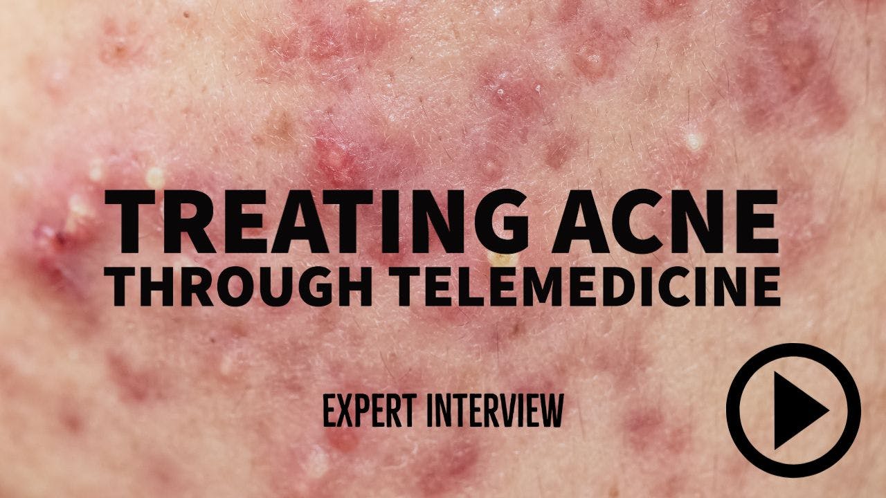 interview with Julie Harper, MD, on treating acne through telemedicine