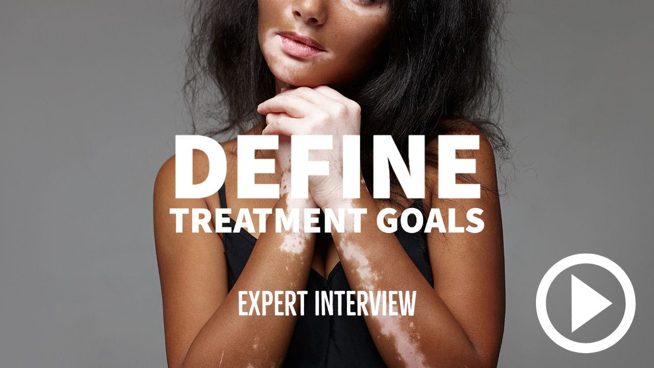 woman with vitiligo. Writing: Define treatment goals - Expert Interview