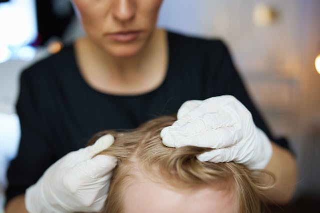 Dermatology Clinicians Prefer Topical Corticosteroids in Pediatric Patients With Alopecia Areata, Study Finds