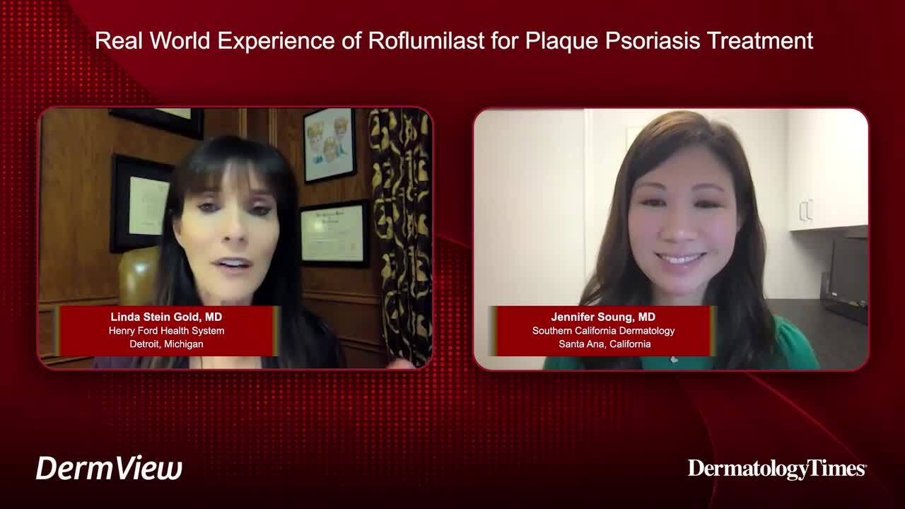Real World Experience of Roflumilast for Plaque Psoriasis Treatment 