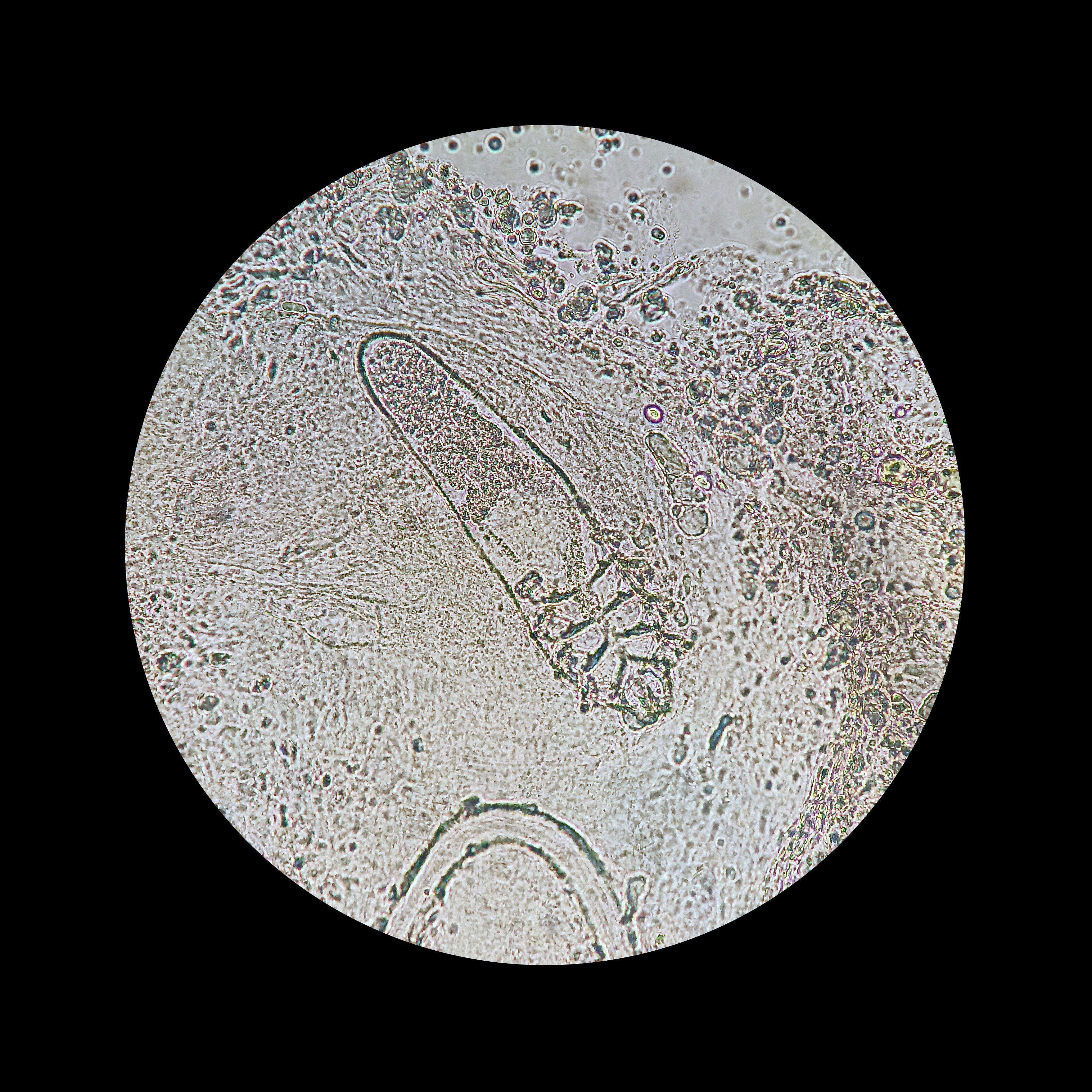 Demodex mite from a microscope view