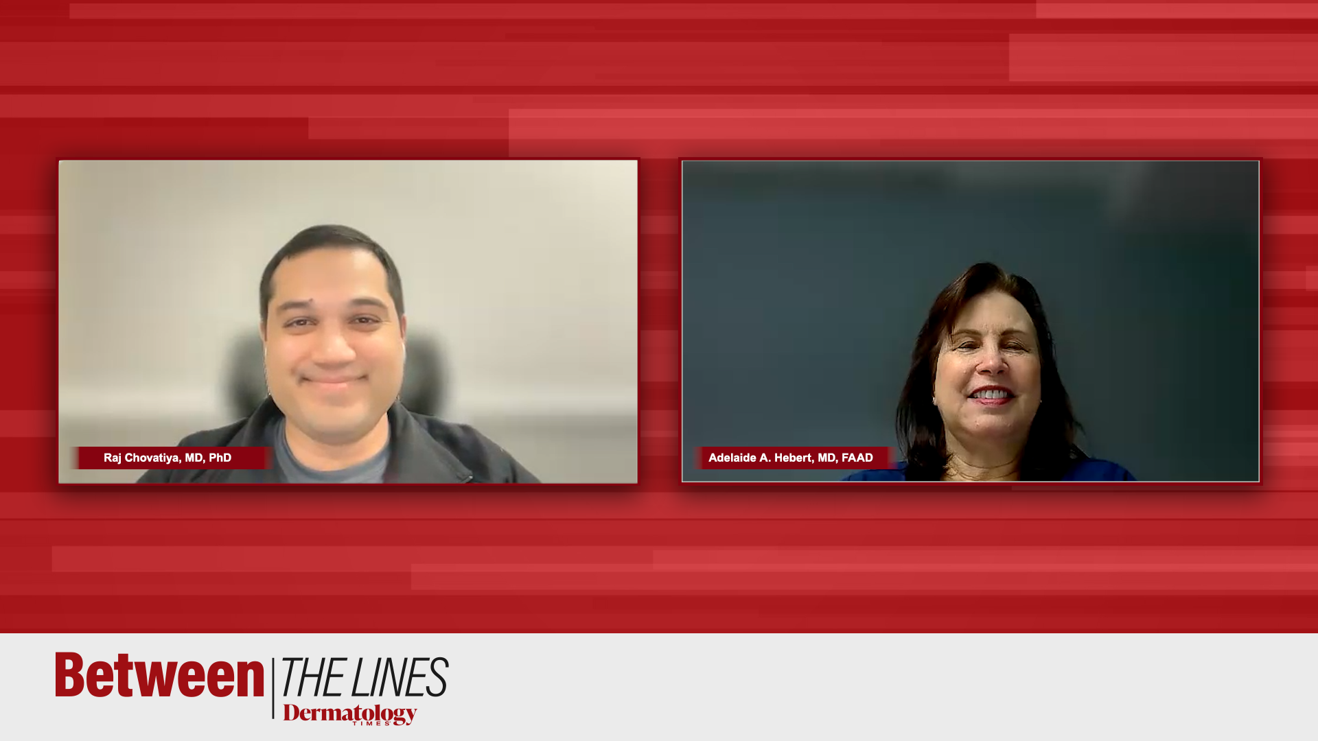 Chovatiya discussed new tapinarof data in a recent Dermatology Times Between the Lines video program.