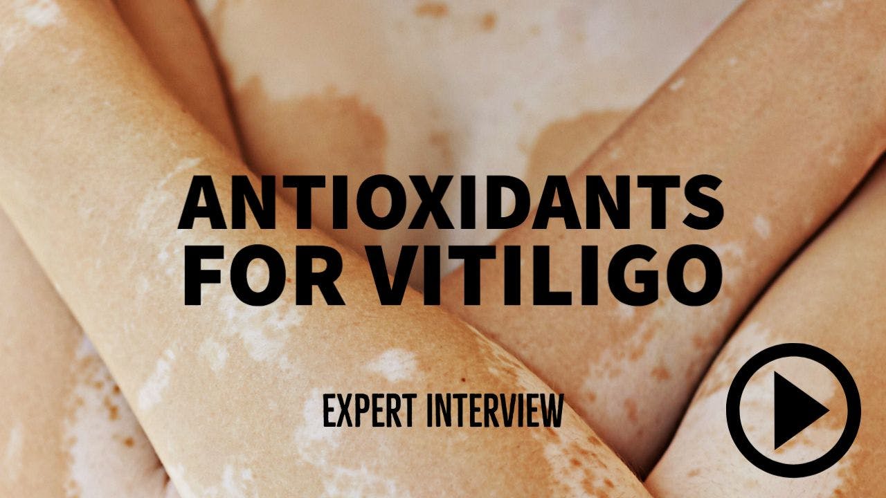 person with vitiligo crossing arms. Writing: Antioxidants for Vitiligo.