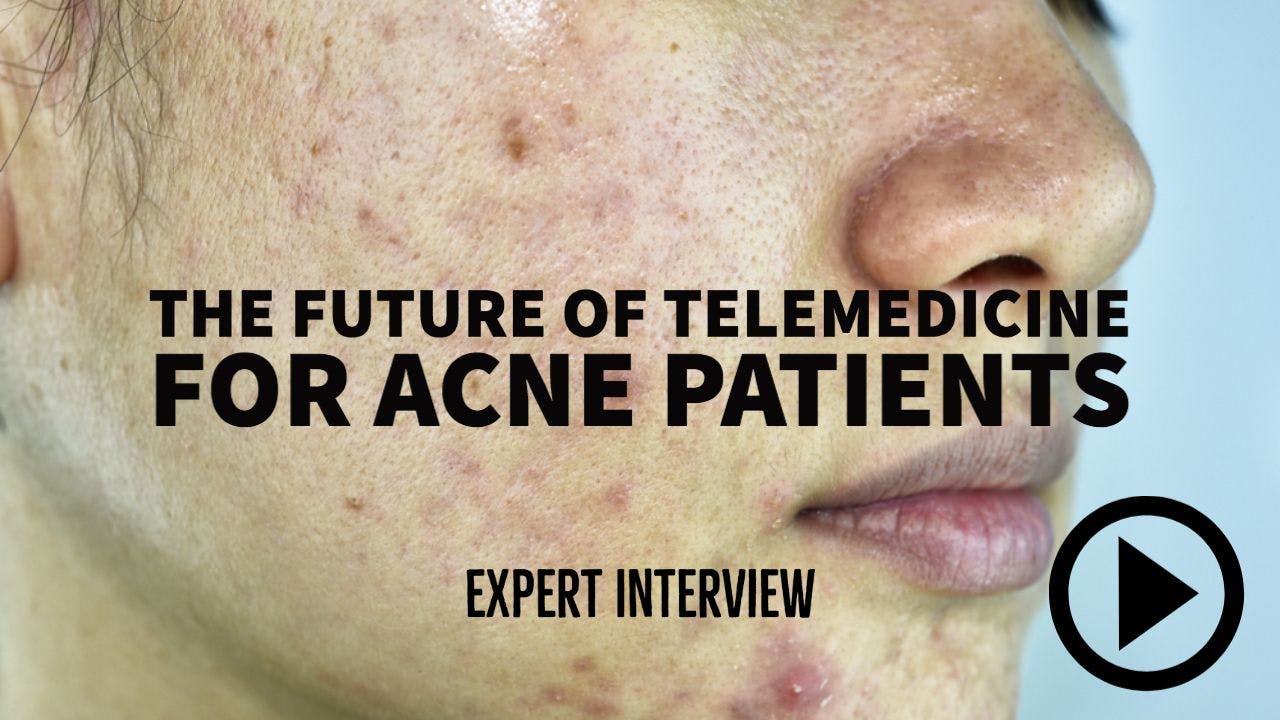 Interview with Julie Harper, MD, on the impact of telehealth on the future of acne care  