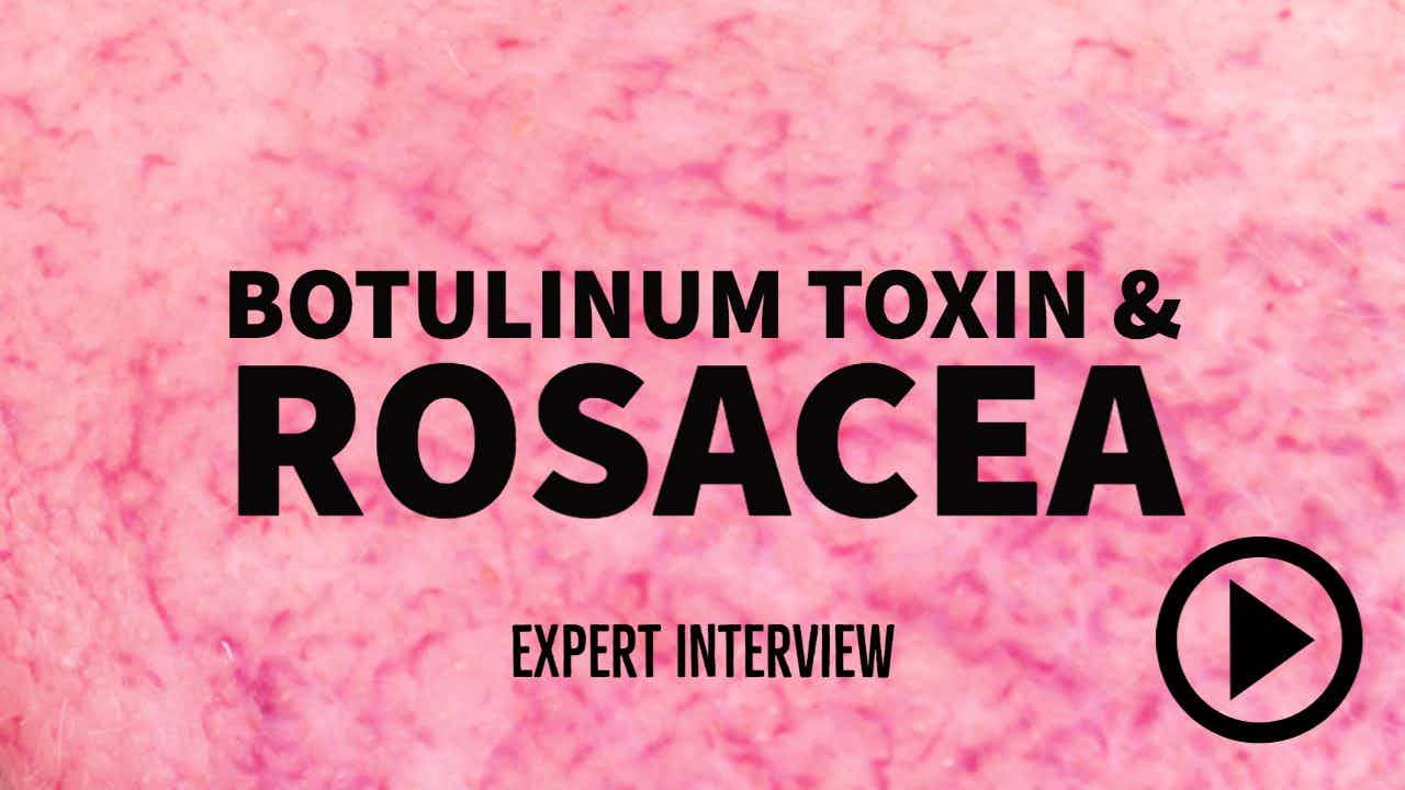Botulinum toxin for rosacea
