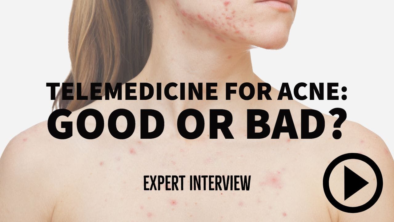 interview with Julie Harper on treating acne through telemedicine